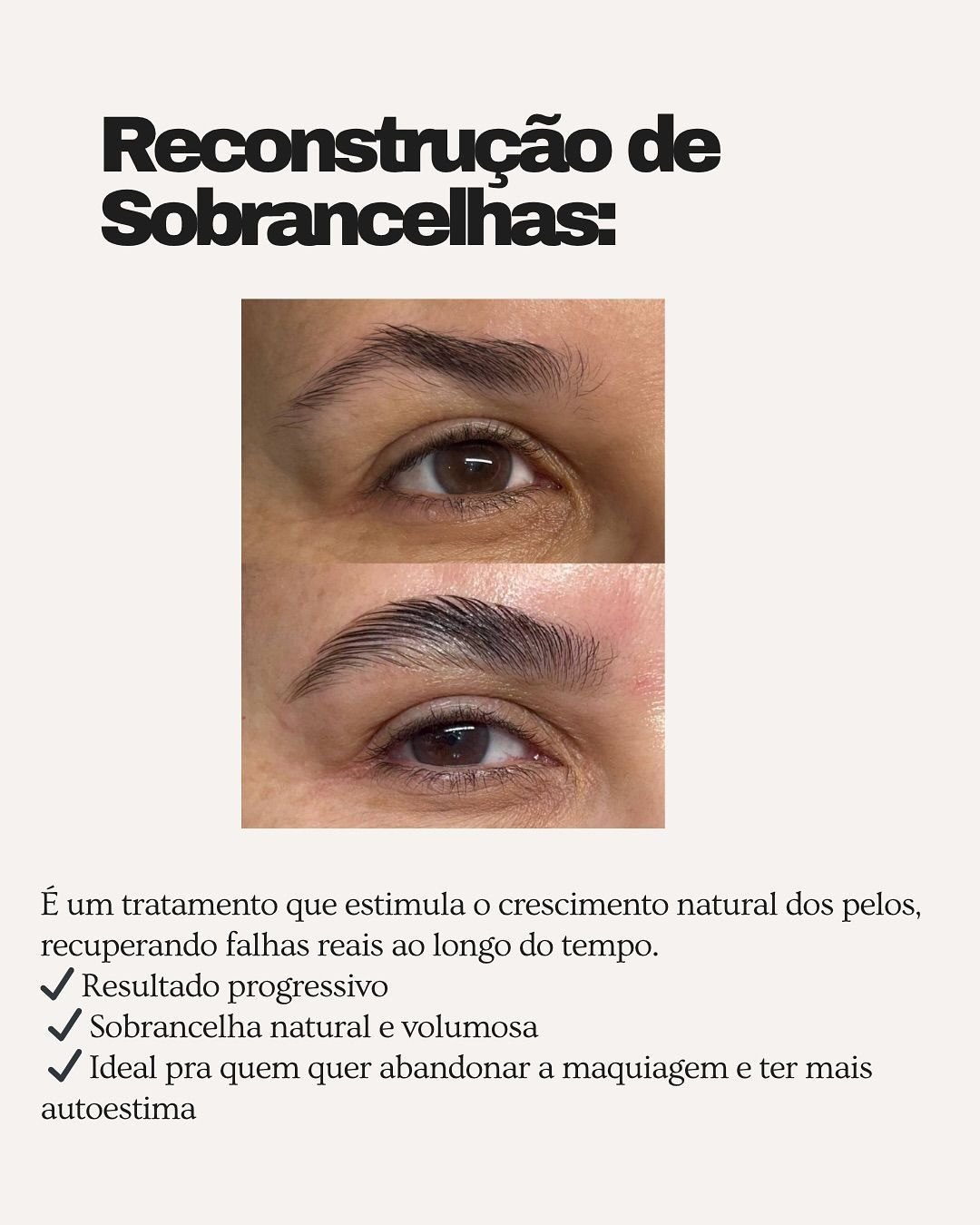 Resultado de reconstrução de sobrancelhas