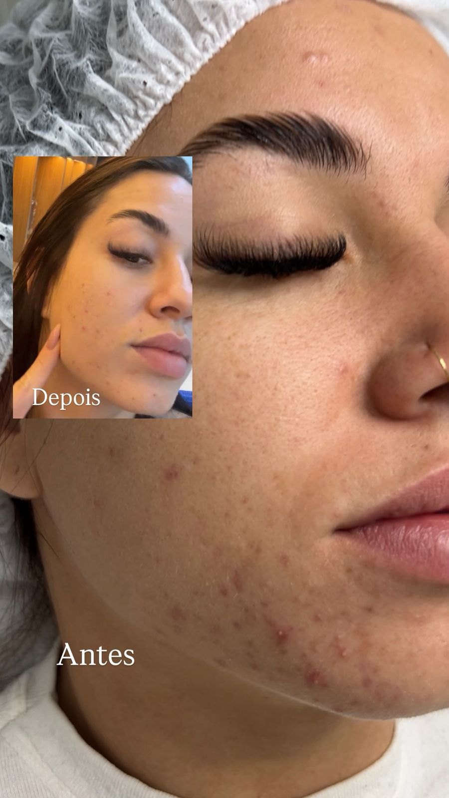 Tratamento facial e cílios